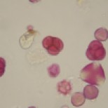Dandelion, Apple, Oil Seed Rape and Heather pollen grains visible